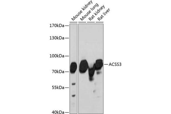 ACSS3 Antikörper  (AA 30-280)