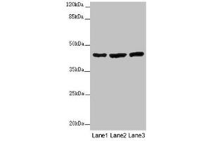 Western blot All lanes: MTERF4 antibody at 2 μg/mL Lane 1: Mouse kidney tissue Lane 2: HL60 whole cell lysate Lane 3: A549 whole cell lysate Secondary Goat polyclonal to rabbit IgG at 1/10000 dilution Predicted band size: 44 kDa Observed band size: 44 kDa