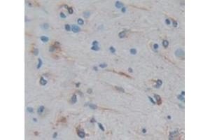 Figure. (CCDC3 anticorps  (AA 22-251))