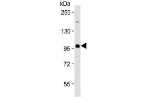 Western blot testing of human Raji cell lysate with MAP4K1 antibody at 1:2000. (MAP4K1 anticorps)