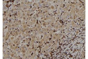 ABIN6257460 and ABIN6273388 at 1/100 staining Human liver tissue by IHC-P. (RIOK2 anticorps  (Internal Region))