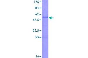 Image no. 1 for Oligodendrocyte Transcription Factor 1 (OLIG1) (AA 1-255) protein (GST tag) (ABIN1313379)