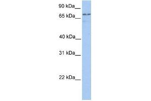 Transglutaminase 7 antibody used at 1 ug/ml to detect target protein.