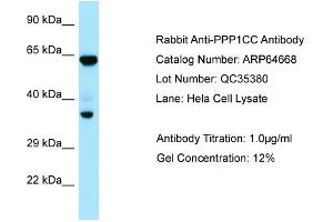 Western Blotting (WB) image for anti-Protein Phosphatase 1, Catalytic Subunit, gamma Isoform (PPP1CC) (C-Term) antibody (ABIN2789917) (PPP1CC anticorps  (C-Term))