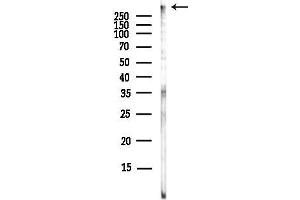Western blot analysis of lysates from EC304 cells(LPS,4h treatment), using DNA PK Antibody at 1/1000 dilution.