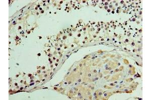 Immunohistochemistry of paraffin-embedded human testis tissue using ABIN7175278 at dilution of 1:100 (MON1A anticorps  (AA 205-555))