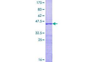 Image no. 1 for Ribosomal Protein S15 (RPS15) (AA 1-145) protein (GST tag) (ABIN1318743)