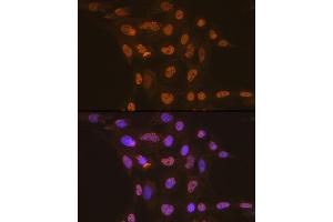 Immunofluorescence analysis of C6 cells using CDC16 Rabbit mAb (ABIN1678585, ABIN3017837, ABIN3017838 and ABIN7101525) at dilution of 1:100 (40x lens). (CDC16 anticorps)