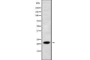 Western blot analysis IL28A using 293 whole cell lysates (IL28A anticorps  (N-Term))