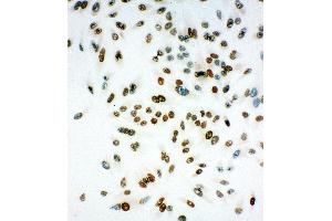 Anti-MCM6 antibody, ICC ICC: HELA Cell