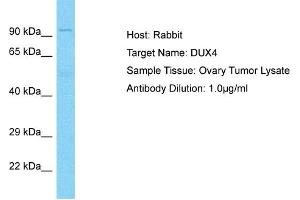 Host: Rabbit Target Name: DUX4 Sample Type: Ovary tumor lysates Antibody Dilution: 1.