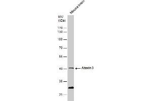WB Image Ataxin 3 antibody detects Ataxin 3 protein by western blot analysis. (Ataxin 3 anticorps)