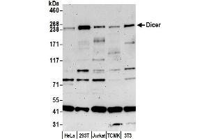 Western Blotting (WB) image for anti-Dicer 1, Ribonuclease Type III (DICER1) (AA 600-650) antibody (ABIN7450171)