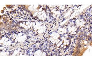 Detection of HMGB1 in Rat Colon Tissue using Polyclonal Antibody to High Mobility Group Protein 1 (HMGB1) (HMGB1 anticorps  (AA 1-215))