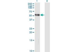 Western Blot analysis of AGT expression in transfected 293T cell line by AGT monoclonal antibody (M04), clone 3C10.