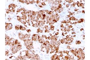 Formalin-fixed, paraffin-embedded human Pituitary stained with Growth Hormone Mouse Monoclonal Antibody (GH/3155).