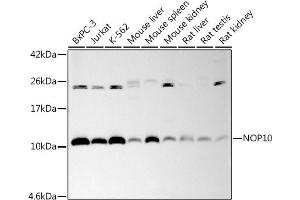 Western blot analysis of extracts of various cell lines, using (ABIN7268953) at 1:1000 dilution.