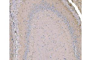 IHC analysis of IRBIT/AHCYL1 using anti-IRBIT/AHCYL1 antibody (ABIN7600030). (AHCYL1 anticorps  (AA 14-57))