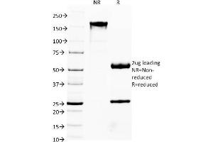 SDS-PAGE Analysis Purified FOXA1 Monoclonal Antibody (FOXA1/1541). (FOXA1 anticorps  (AA 372-472))