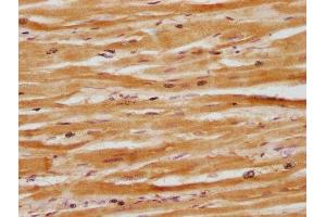 IHC image of ABIN7164419 diluted at 1:100 and staining in paraffin-embedded human heart tissue performed on a Leica BondTM system. (Deltex Homolog 3 anticorps  (AA 90-347))