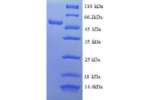 SDS-PAGE (SDS) image for Lectin, Galactose Binding, Soluble 5 (LGALS5) (AA 2-187), (partial) protein (GST tag) (ABIN5712189) (Lectin, Galactose Binding, Soluble 5 (LGALS5) (AA 2-187), (partial) protein (GST tag))