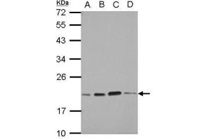 WB Image Sample (30 ug of whole cell lysate) A: A549 B: H1299 C: HCT116 D: MCF-7 12% SDS PAGE antibody diluted at 1:1000 (SKP1 anticorps)