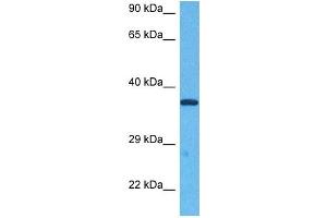 Host:  Rabbit  Target Name:  E2F5  Sample Tissue:  Human Jurkat Whole Cell  Antibody Dilution:  1ug/ml (E2F5 anticorps  (N-Term))