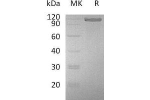 Western Blotting (WB) image for Activated Leukocyte Cell Adhesion Molecule (ALCAM) protein (Fc Tag) (ABIN7320462)