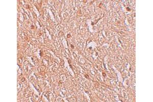 Immunohistochemical staining of human brain cells with LMBRD1 polyclonal antibody  at 2. (LMBRD1 anticorps  (C-Term))