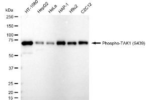Western blotting analysis using Phospho-TAK1 (S439) antibody (ABIN7799653).