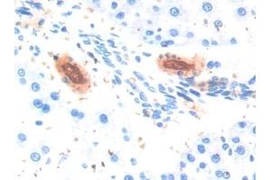 Detection of ADPN in Rat Liver Tissue using Polyclonal Antibody to Adiponectin (ADPN) (ADIPOQ anticorps  (AA 111-244))