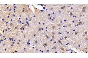 Detection of FADD in Mouse Cerebrum Tissue using Polyclonal Antibody to Fas Associating Death Domain Containing Protein (FADD)