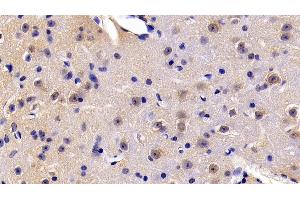 Detection of FADD in Mouse Cerebrum Tissue using Polyclonal Antibody to Fas Associating Death Domain Containing Protein (FADD) (FADD anticorps  (AA 7-178))