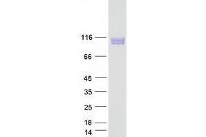 Validation with Western Blot