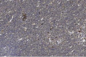 Immunohistochemical analysis of paraffin-embedded Human Thymus section using Pink1 am2199b.