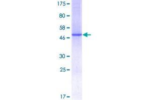 Image no. 1 for Complement Component 1, Q Subcomponent, C Chain (C1QC) (AA 1-245) protein (GST tag) (ABIN1347374)