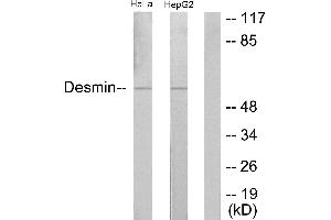Immunohistochemistry analysis of paraffin-embedded human colon carcinoma tissue using Desmin (Ab-60) antibody. (Desmin anticorps)