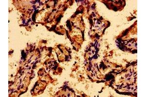 Immunohistochemistry of paraffin-embedded human placenta tissue using ABIN7168566 at dilution of 1:100 (Sacsin anticorps  (AA 983-1150))
