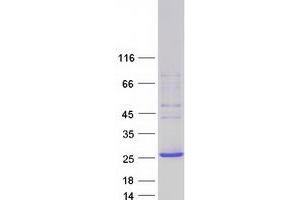 Validation with Western Blot
