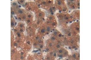 IHC-P analysis of Human Tissue, with DAB staining. (REV1 anticorps  (AA 472-652))