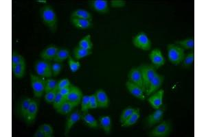 Immunofluorescence staining of HepG2 cells with ABIN7150084 at 1:166, counter-stained with DAPI. (DLGAP2 anticorps  (AA 31-139))
