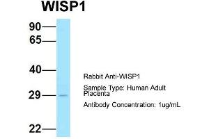 Host: Rabbit  Target Name: WISP1  Sample Tissue: Human Adult Placenta  Antibody Dilution: 1.