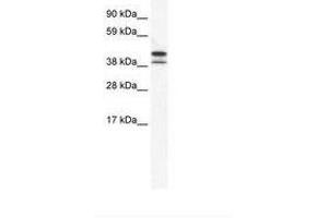 Image no. 1 for anti-TATA Box Binding Protein Like 2 (Tbpl2) (AA 53-102) antibody (ABIN202310) (Tbpl2 anticorps  (AA 53-102))