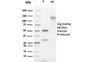 SDS-PAGE Analysis of Purified HSP60 Rabbit Recombinant Monoclonal Antibody (HSPD1/2206R). (Recombinant HSPD1 anticorps)