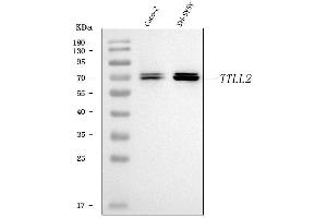 Western blot analysis of TTLL2 using anti-TTLL2 antibody (ABIN7600850).