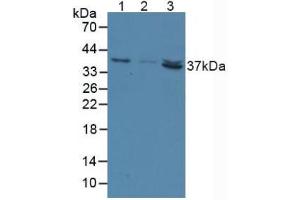 Figure. (NT5C3 anticorps  (AA 52-336))