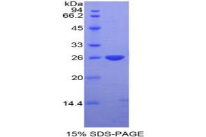 SDS-PAGE analysis of Mouse DIXDC1 Protein. (DIXDC1 Protéine)