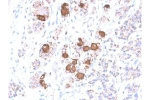 IHC testing of FFPE human pituitary gland with recombinant ACTH antibody (clone CLIP/2040R). (CLIP anticorps  (AA 25-39))