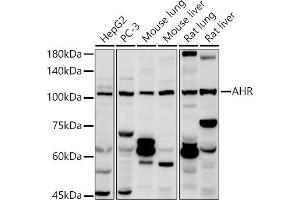 Western blot analysis of extracts of various cell lines, using AHR antibody (ABIN3015499, ABIN3015500, ABIN5663909 and ABIN6218543) at 1:1000 dilution.