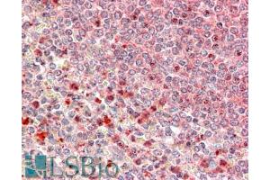 ABIN570777 (5µg/ml) staining of paraffin embedded Human Spleen. (UBR4 anticorps  (C-Term))